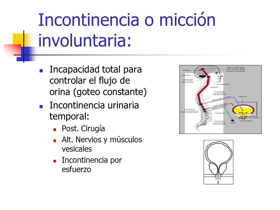 micción temporal frecuente